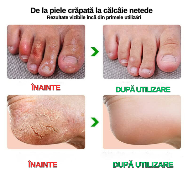 Cremă de Îngrijire a Picioarelor