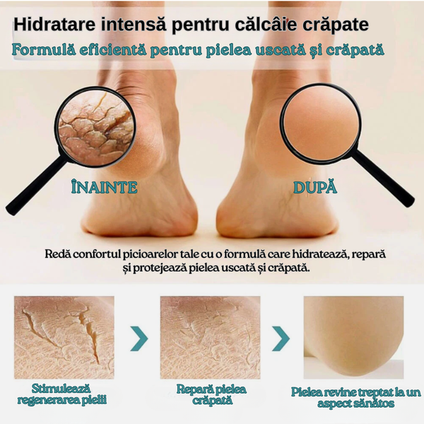 Hidratare intensă pentru călcâie crăpate.png